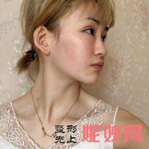 上海美莱医疗美容门诊部邱阳医生靠谱吗_去老年斑靠谱吗