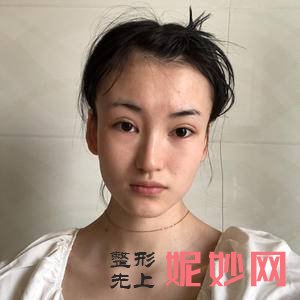 上海美莱医疗美容门诊部邱阳医生靠谱吗_去老年斑靠谱吗