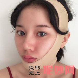 邱阳