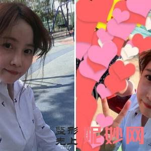 苏州美贝尔整形美容医院朱关龙医生技术怎么样_人中缩短技术怎么样_坐诊时间