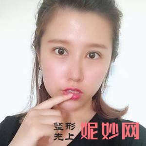 苏州美贝尔整形美容医院朱关龙医生技术怎么样_人中缩短技术怎么样_坐诊时间