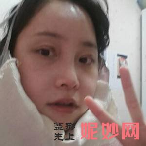 苏州美贝尔整形美容医院朱关龙医生技术怎么样_人中缩短技术怎么样_坐诊时间