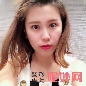 苏州美贝尔整形美容医院朱关龙医生技术怎么样_人中缩短技术怎么样_坐诊时间