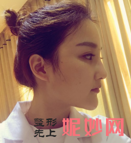 成都蓉雅晶肤医疗美容门诊部燕红医生靠谱吗_激光去雀斑靠谱吗