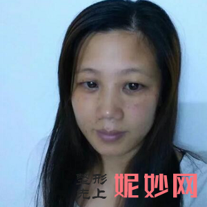 成都蓉雅晶肤医疗美容门诊部燕红医生靠谱吗_激光去雀斑靠谱吗