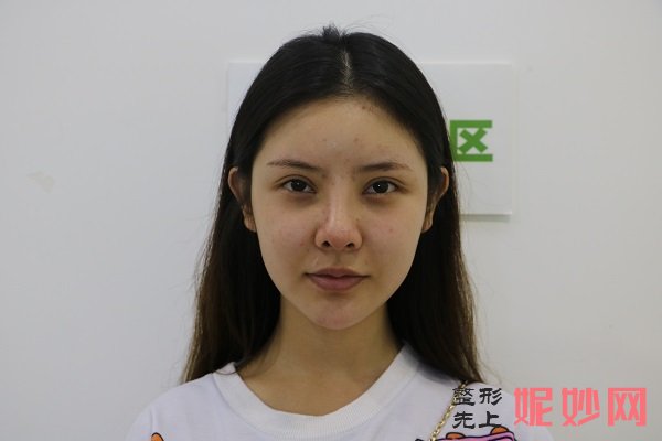 广州紫馨韩国定制整形美容赵晟弼医生技术好不好_牙颌畸形矫正技术好不好_门诊时间表