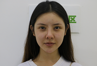 广州紫馨韩国定制整形美容赵晟弼医生技术好不好_牙颌畸形矫正技术好不好_门诊时间表