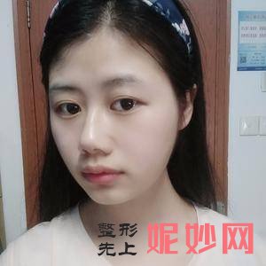 广州紫馨韩国定制整形美容郑宰昊医生技术怎么样_耳垂整形技术怎么样_坐诊时间_案例效果