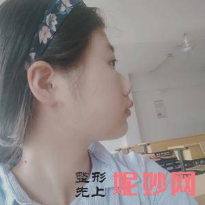 郑宰昊
