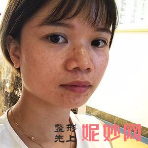 广州紫馨韩国定制整形美容肖和医生好不好_唇腭裂畸形二期修复好不好_坐诊时间