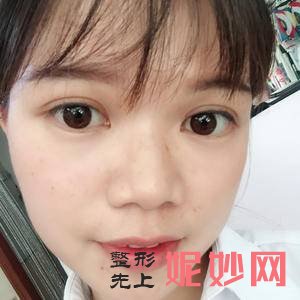 广州紫馨韩国定制整形美容肖和医生好不好_唇腭裂畸形二期修复好不好_坐诊时间