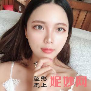 保定华美医疗整形美容医院怎么样?附2021较新整形案例