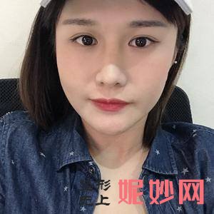 银川澳玛星光医疗美容诊所徐军医生靠谱吗_除皱针去露龈笑靠谱吗_出诊时间