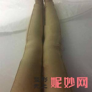 杨星