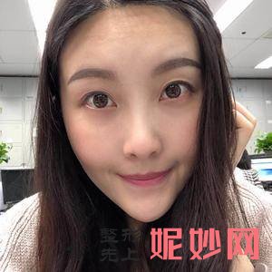 北京协和医院整形美容科王智医生靠谱吗_去眼袋失败修复靠谱吗