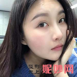 王智