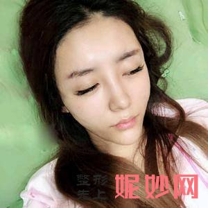 北京协和医院整形美容科王智医生靠谱吗_去眼袋失败修复靠谱吗