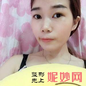 北京协和医院整形美容科丁文蕴医生怎么样_蛋白线埋线提升颈部怎么样