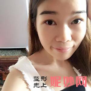 北京协和医院整形美容科丁文蕴医生怎么样_蛋白线埋线提升颈部怎么样