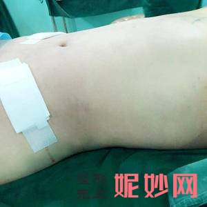 北京协和医院整形美容科龙飞医生怎么样_超体隆鼻怎么样_出诊时间