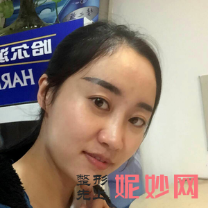 北京协和医院整形美容科宋可新医生好不好_去颈纹好不好