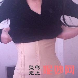 贵阳利美康整形外科医院骆显红医生靠谱吗_膨体丰额头靠谱吗_坐诊时间_案例前后对比照