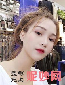 贵阳利美康整形外科医院骆显红医生靠谱吗_膨体丰额头靠谱吗_坐诊时间_案例前后对比照