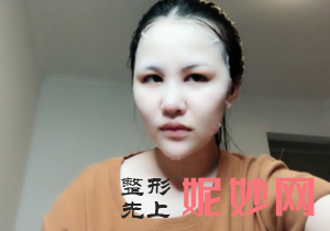 贵阳利美康整形外科医院王颖医生怎么样_牙周护理怎么样_坐诊时间
