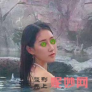 贵阳利美康整形外科医院梁安裕医生技术好不好_玻尿酸丰泪沟技术好不好