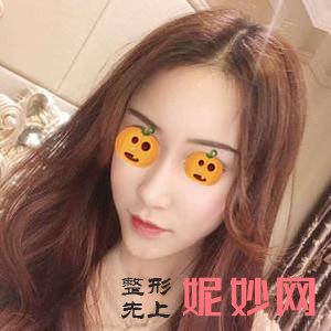 贵阳利美康整形外科医院梁安裕医生技术好不好_玻尿酸丰泪沟技术好不好