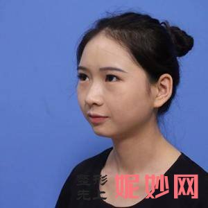 北京美莱医疗美容医院戴琴医生怎么样_半永久化妆怎么样