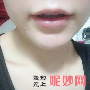 西安未央施尔绮医疗整形医院赵春英医生技术好不好_半永久化妆技术好不好_出诊时间_案例前后对比照
