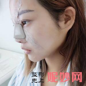 西安未央施尔绮医疗整形医院赵春英医生技术好不好_半永久化妆技术好不好_出诊时间_案例前后对比照