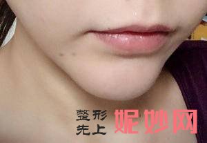 赵春英