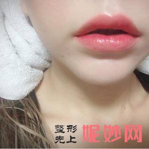 西安未央施尔绮医疗整形医院赵春英医生技术好不好_半永久化妆技术好不好_出诊时间_案例前后对比照
