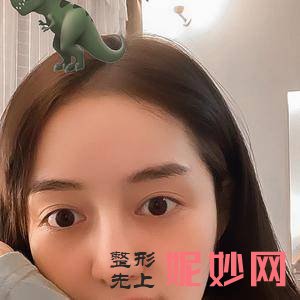 四川悦好医学美容医院胡纯兵医生怎么样_胶原蛋白填充面部怎么样_坐诊时间