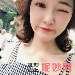 四川悦好医学美容医院陈国双医生靠谱吗_种植鬓角靠谱吗_坐诊时间