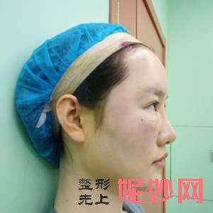 四川悦好医学美容医院王祥医生怎么样_自体脂肪丰额头怎么样_门诊时间表