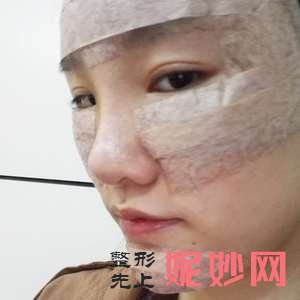 四川悦好医学美容医院王祥医生怎么样_自体脂肪丰额头怎么样_门诊时间表