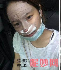 四川悦好医学美容医院王祥医生怎么样_自体脂肪丰额头怎么样_门诊时间表