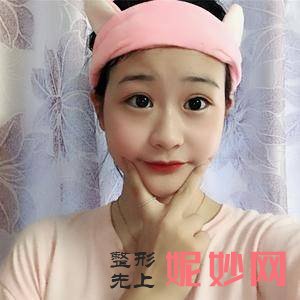 四川悦好医学美容医院向俊妮医生技术怎么样_胸部手术失败修复技术怎么样_坐诊时间