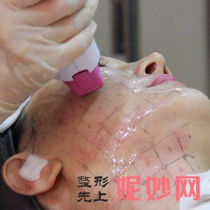 深圳北大医院整形科口碑怎么样？