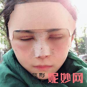 北京蕾士悦医疗美容整形医院怎么样?附2021较新整形案例