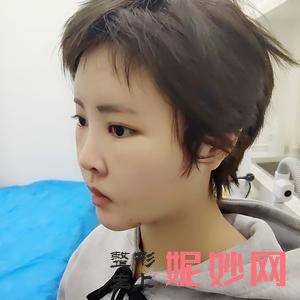 昆明吴氏嘉美医疗整形医院是正规的吗?附2021年较新价格表