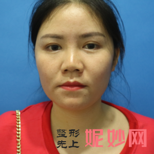 四川娇点医学美容医院是私立医院吗？附2021较新整形案例