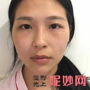 上海百达丽医疗美容怎么样?