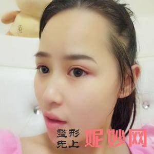北京溪峰聚美仕整形是正规医院吗?附2021较新整形案例