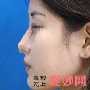 北京花皇医疗美容诊所是公立医院吗？附2021年较新价格表