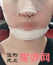 四川娇点医学美容医院是正规医院吗?附2021较新整形案例