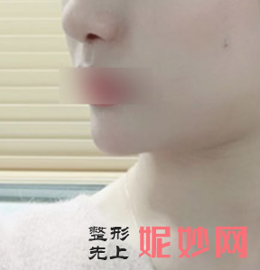 四川娇点医学美容医院是正规医院吗?附2021较新整形案例